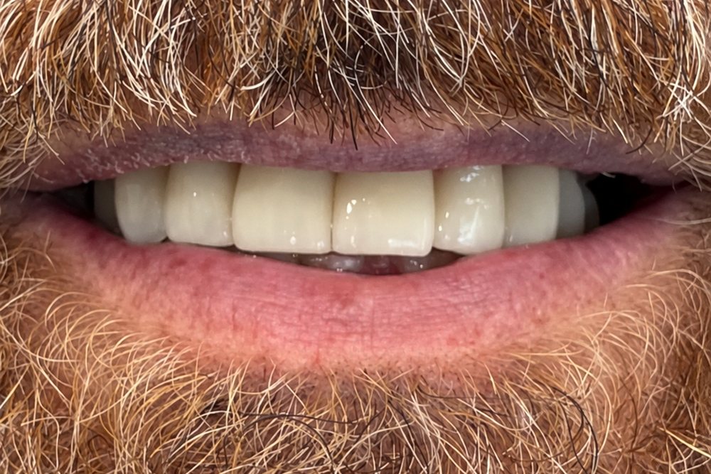 Caso clinico 3: dopo il trattamento