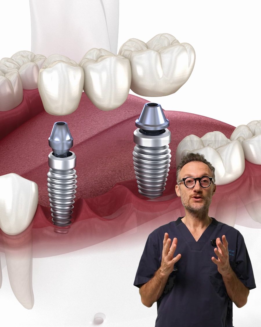 Il Dott. Gaddoni spiega come funzionano gli impianti